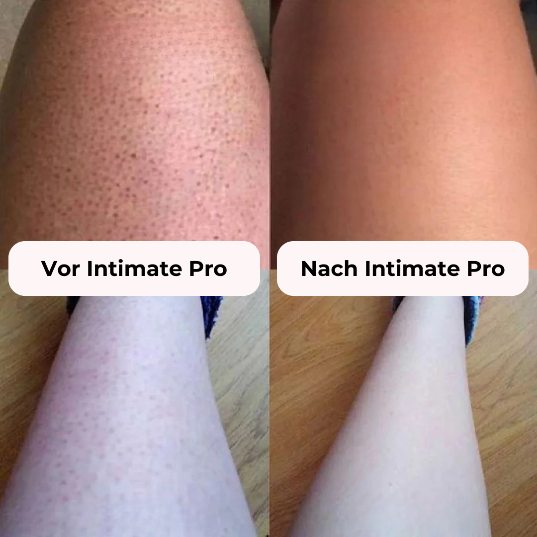 SilkSkin Pro – Sanfte & gründliche Haarentfernung 2-in-1