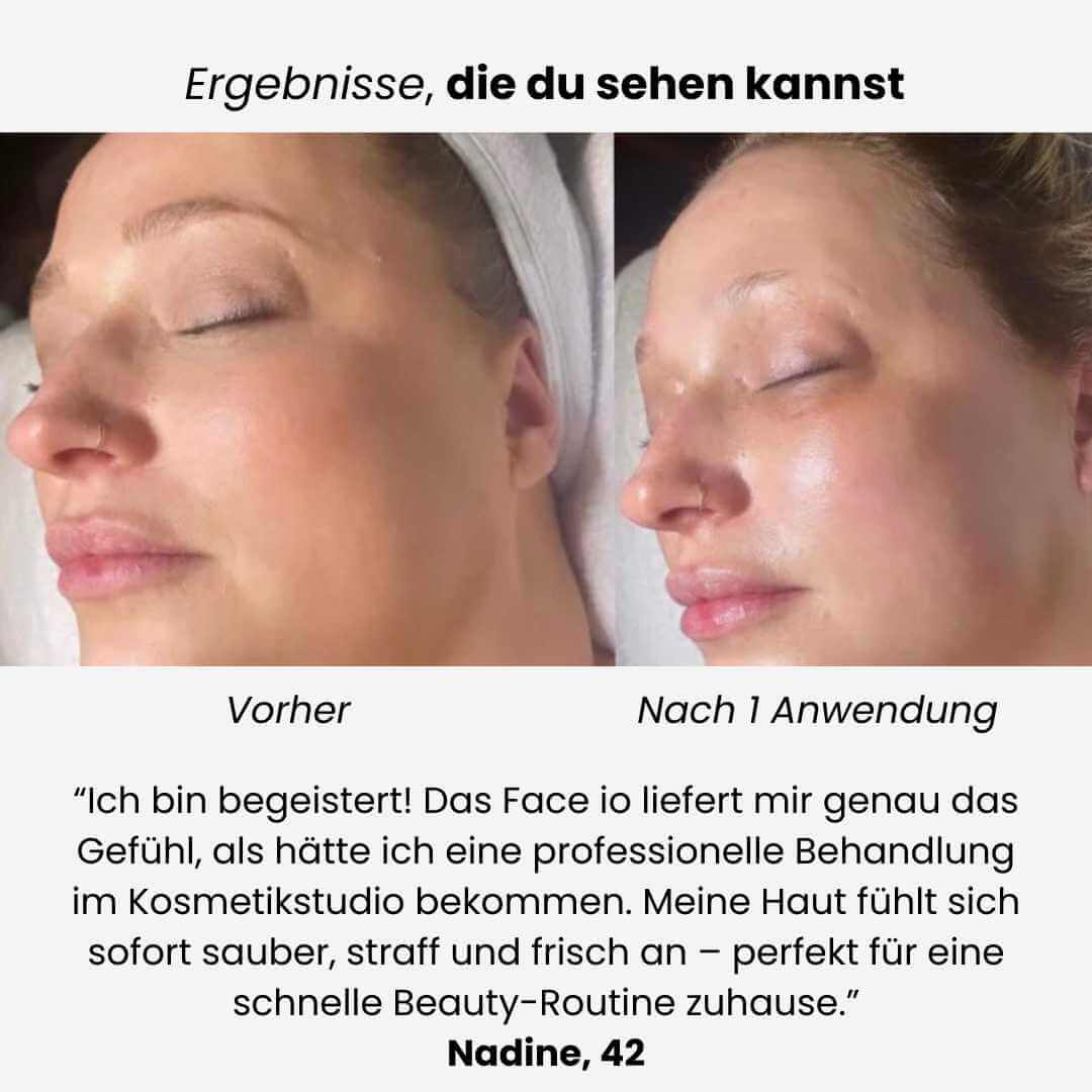 GlowLift One™ – Dein Multitalent für strahlende Haut glätten, straffen, reinigen
