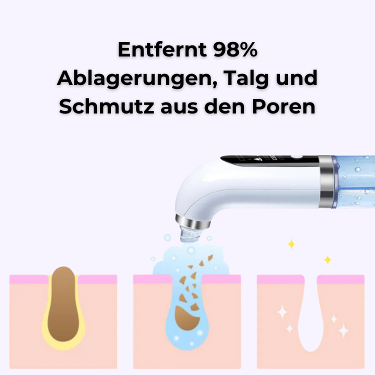 ClearFacial - Porenreiniger