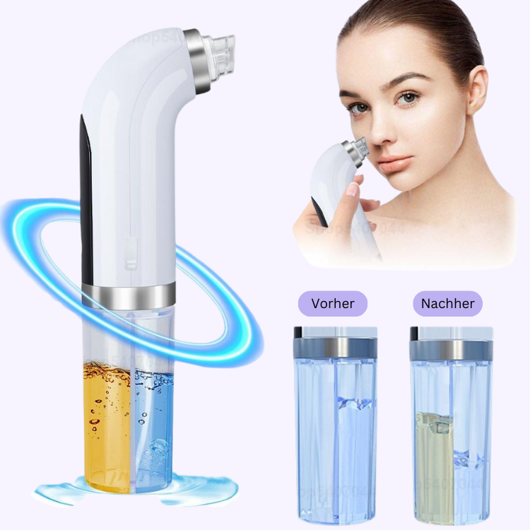 ClearFacial - Porenreiniger