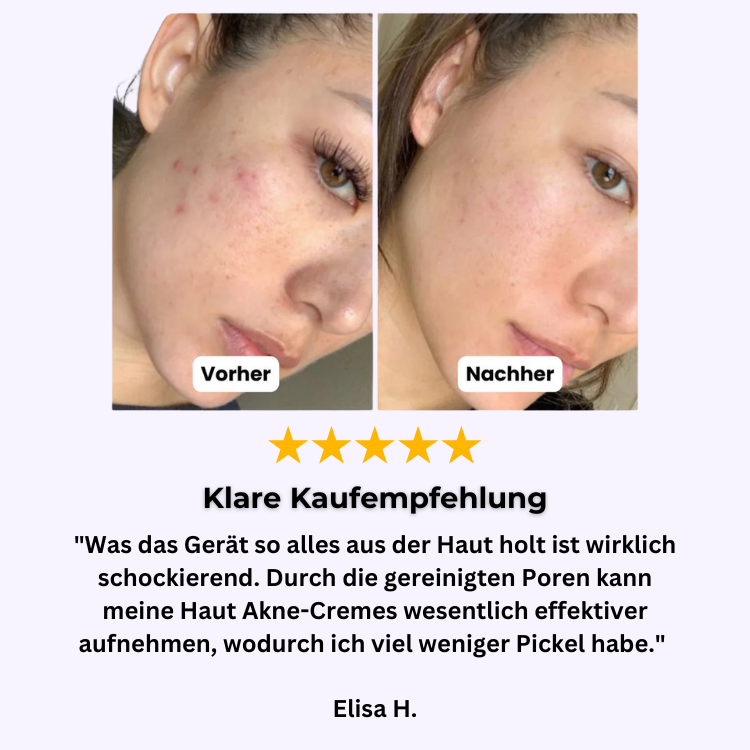 ClearFacial - Porenreiniger