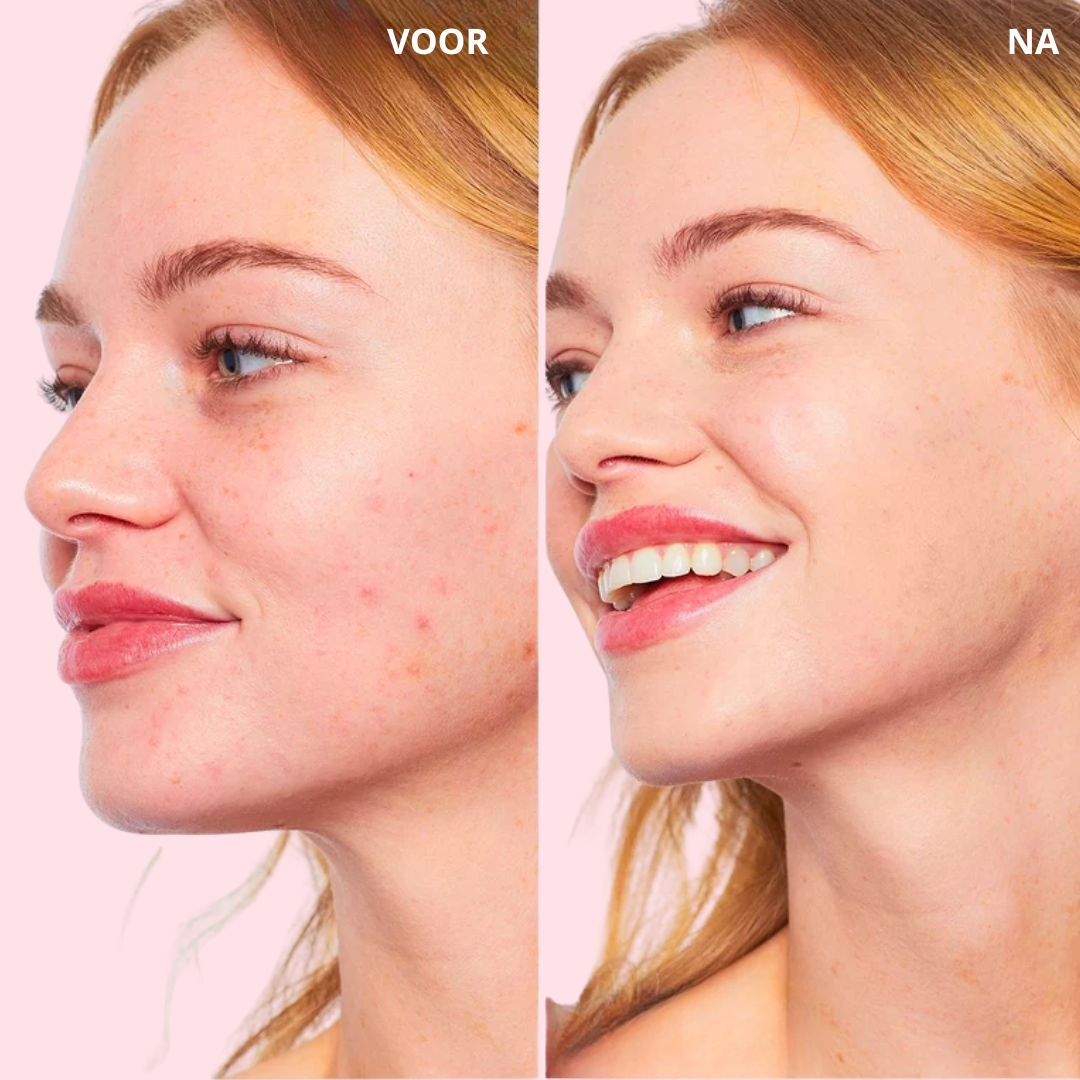 MagicTint™ CC Cream I JETZT 1+1 GRATIS! Von Rötungen zu strahlend schön – deine Haut, nur besser.