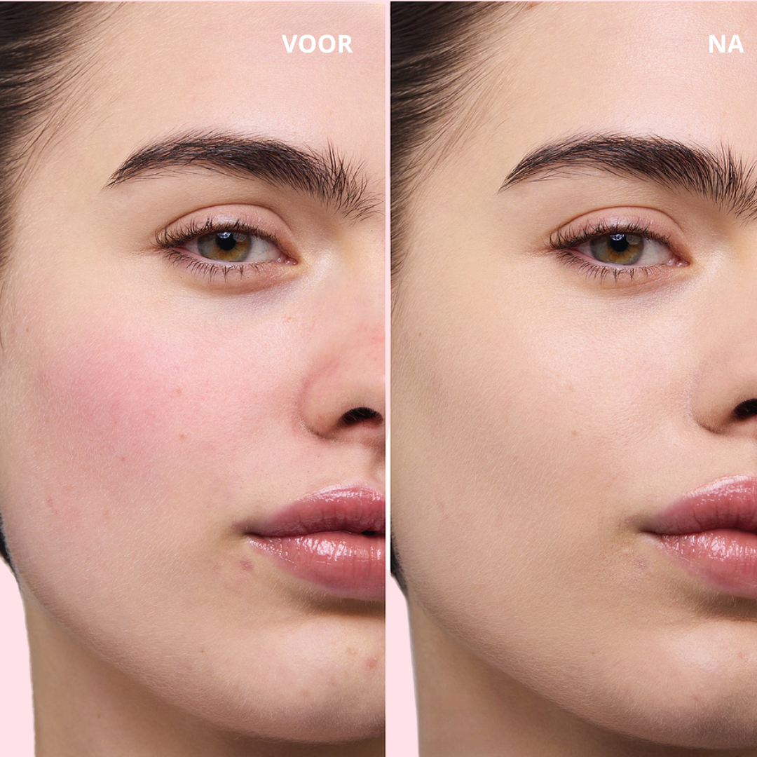 MagicTint™ CC Cream I JETZT 1+1 GRATIS! Von Rötungen zu strahlend schön – deine Haut, nur besser.