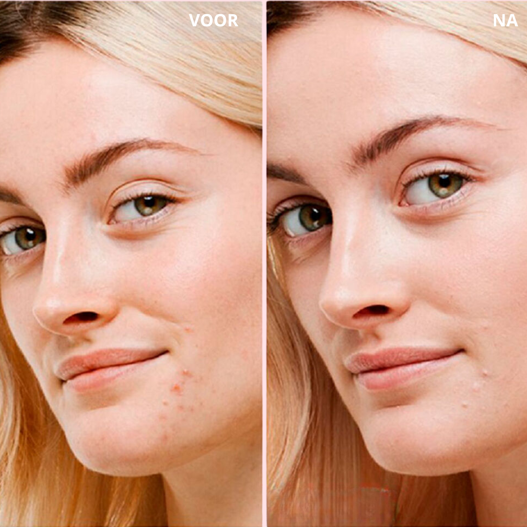 MagicTint™ CC Cream I JETZT 1+1 GRATIS! Von Rötungen zu strahlend schön – deine Haut, nur besser.